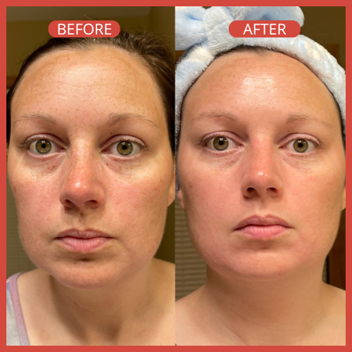 REVITRA-EYE BALM™